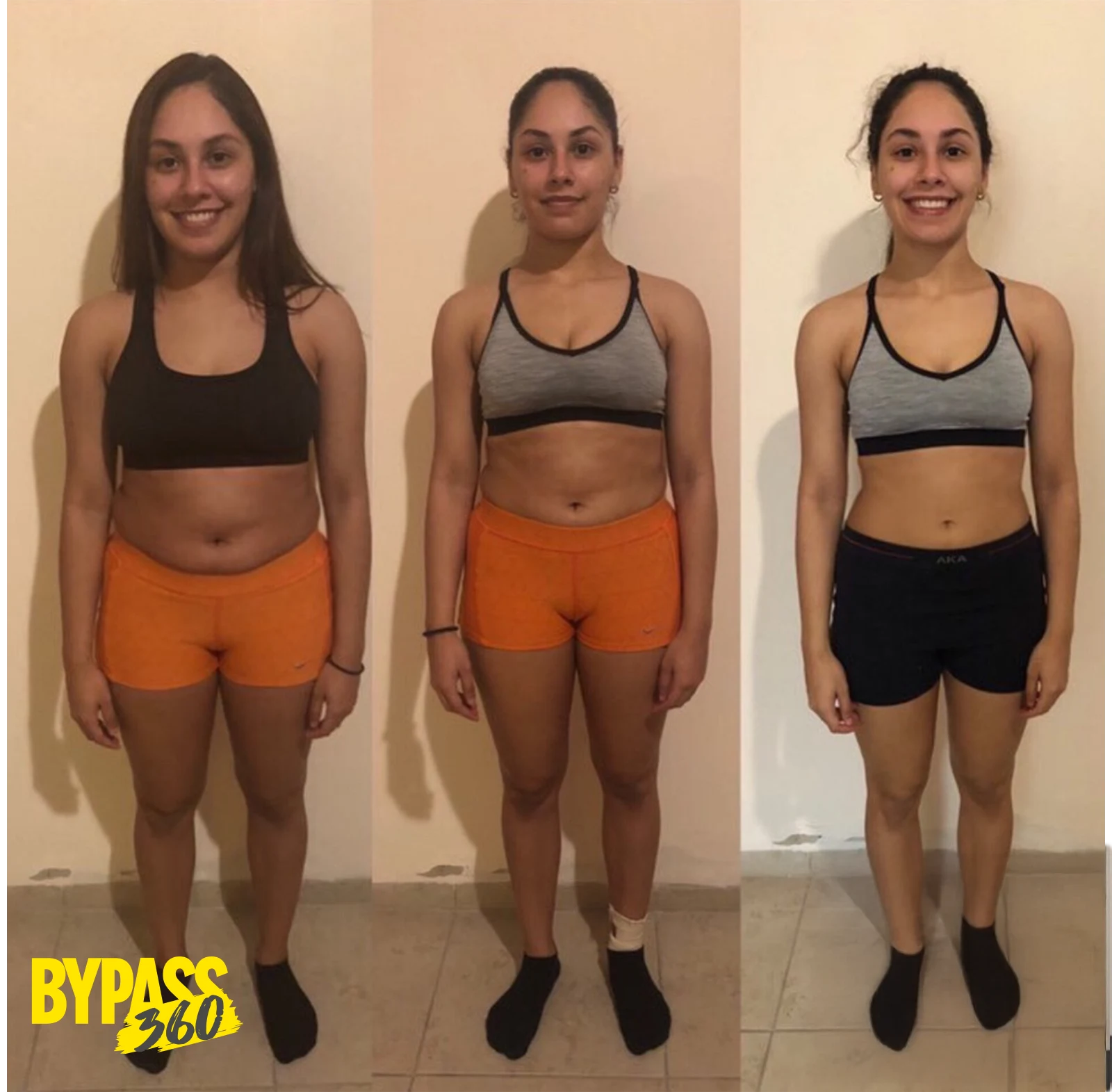 Bypass-4.webp